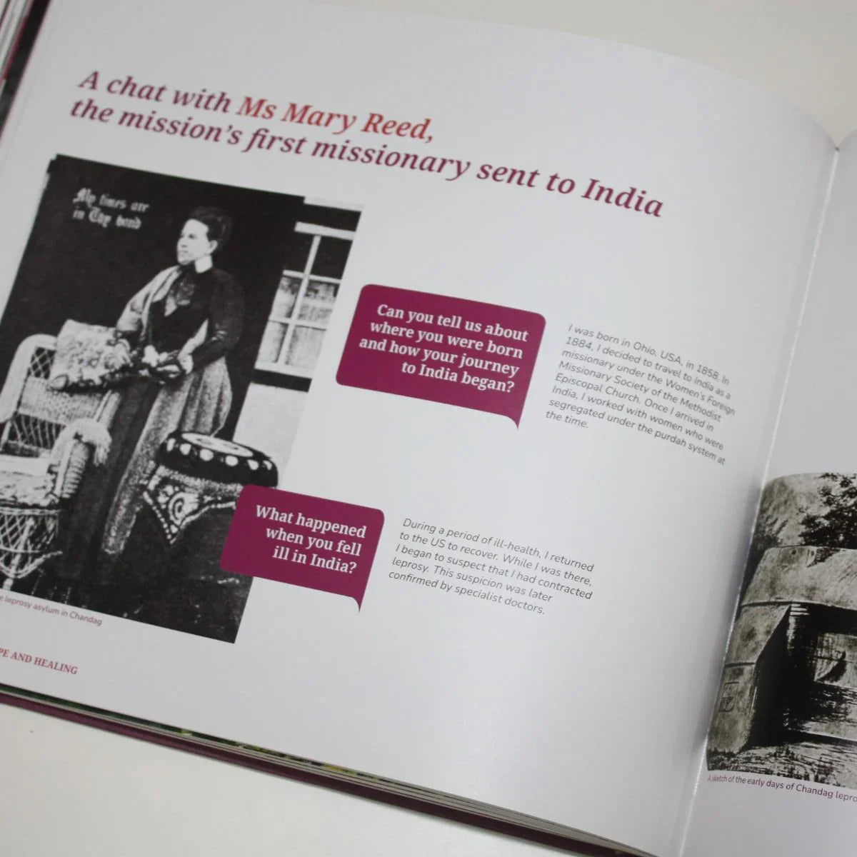 The Leprosy Mission 150 Year Book